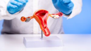 Deep Infiltrating Endometriosis: Symptoms, Diagnosis, and Treatment Options