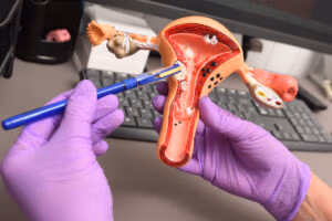 What Are Fibroids? Causes, Signs, and Effective Treatments