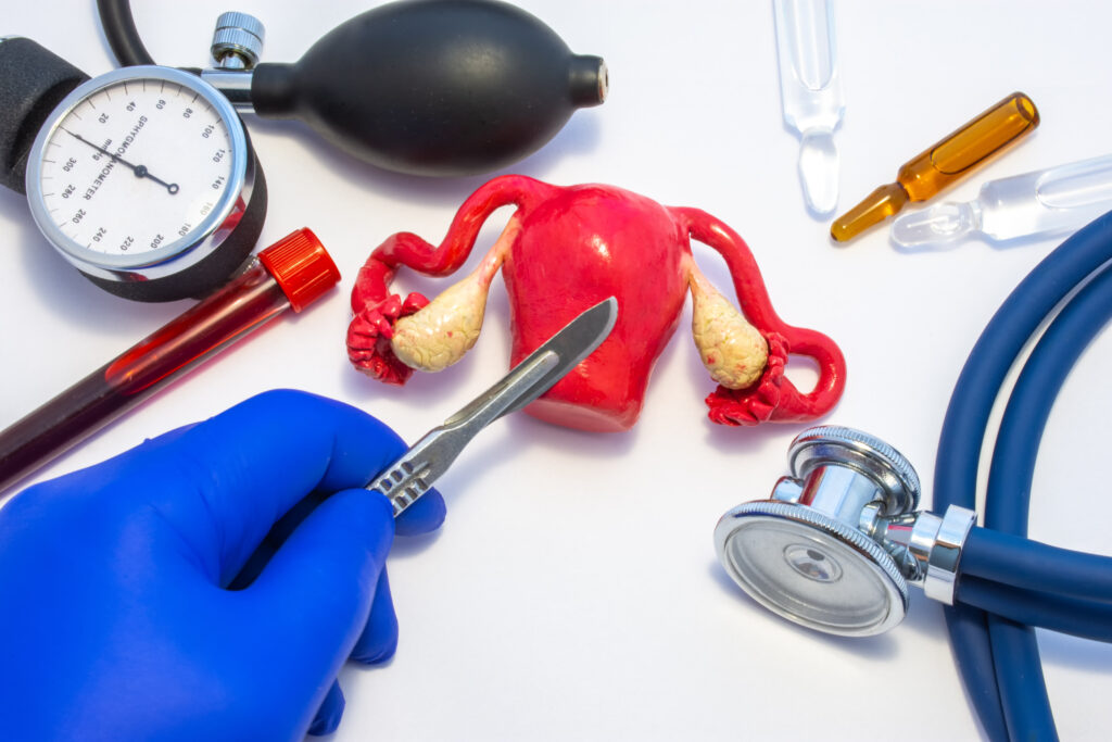 Part 2: Bowel Endometriosis - Treatment, Surgery, and Fertility