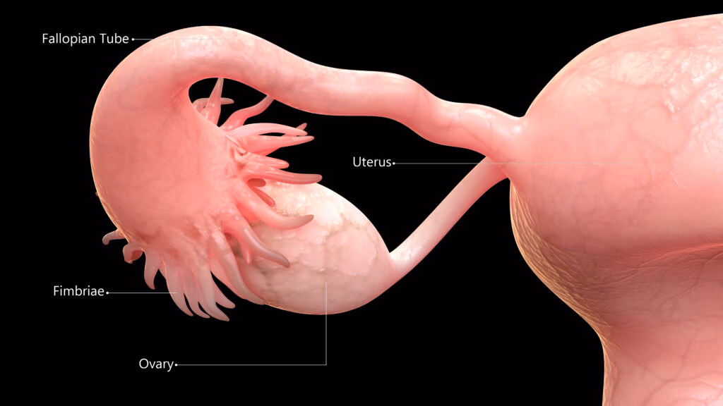 What If Ovarian Cancer Doesn't Start in the Ovary? The Fallopian-Tube Revolution Your Surgeon Should Be Talking About